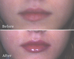 permanent makeup, lips